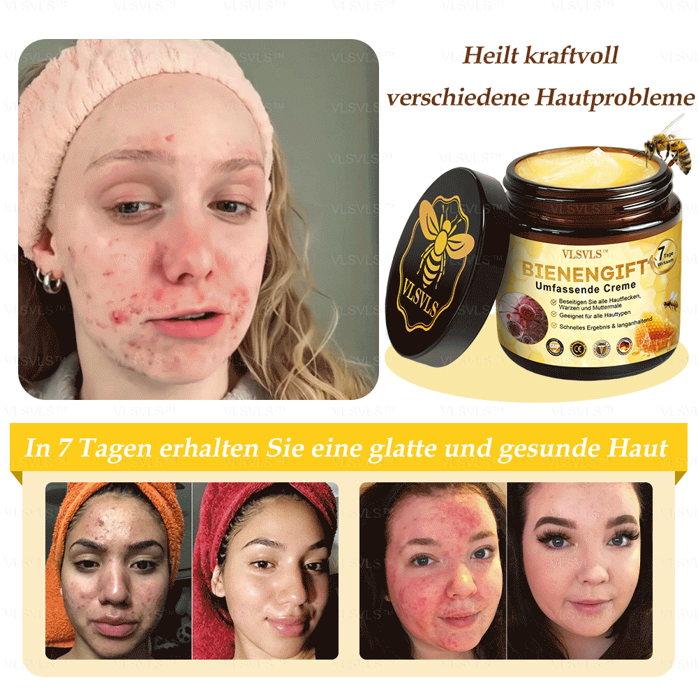 🤎Hergestellt und versendet aus Deutschland  👑VLSVLS® Bienengift Hautregenerationscreme 🔥 LETZTER TAG 80 % RABATT