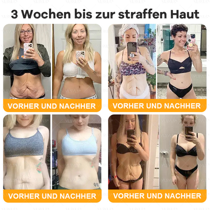 🤎Hergestellt und versendet aus Deutschland  👑VLSVLS® Bienengift Hautregenerationscreme 🔥 LETZTER TAG 80 % RABATT