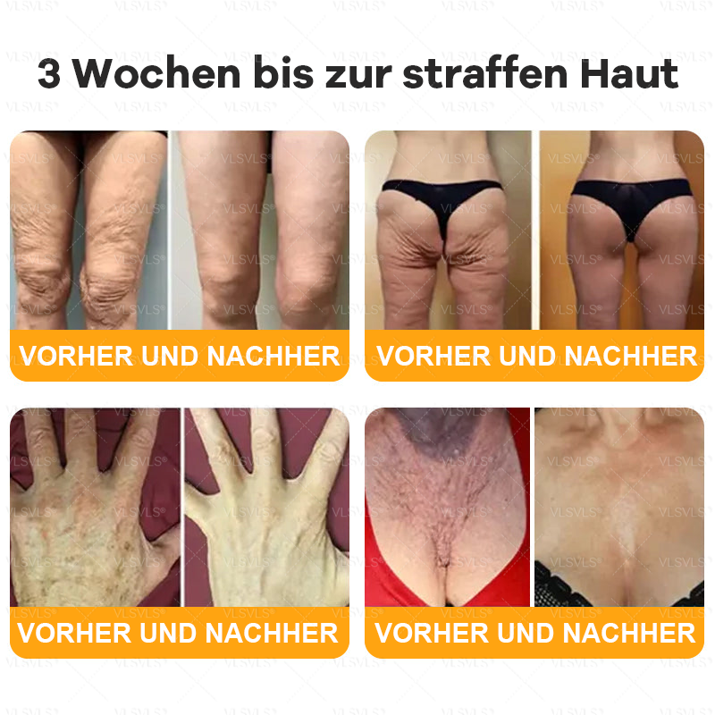 🤎Hergestellt und versendet aus Deutschland  👑VLSVLS® Bienengift Hautregenerationscreme 🔥 LETZTER TAG 80 % RABATT