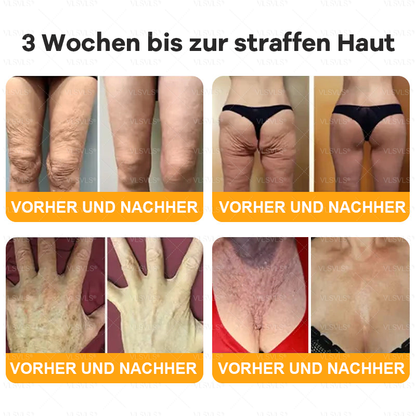 🤎Hergestellt und versendet aus Deutschland  👑VLSVLS® Bienengift Hautregenerationscreme 🔥 LETZTER TAG 80 % RABATT