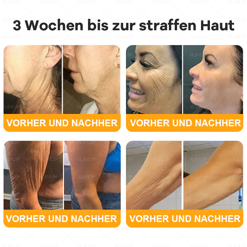 🤎Hergestellt und versendet aus Deutschland  👑VLSVLS® Bienengift Hautregenerationscreme 🔥 LETZTER TAG 80 % RABATT